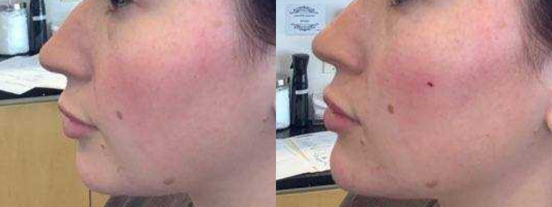 Voluma Case 1 Image