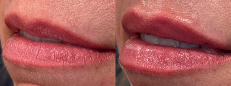 Volbella Case 10 Image